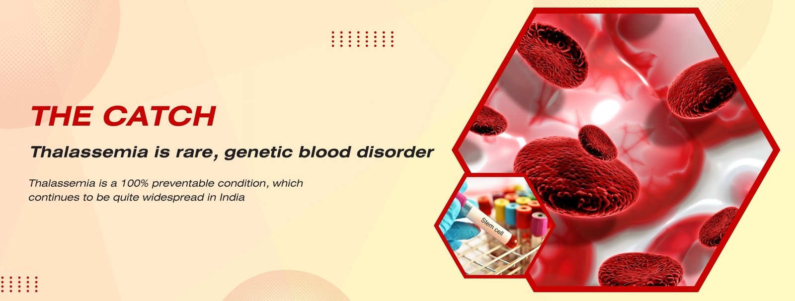 Thalassemia